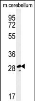 Rabbit Polyclonal Antibody to TESC