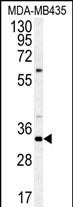 Rabbit Polyclonal Antibody to SGF29  (C-term)