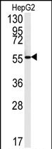 Rabbit Polyclonal Antibody to FAAH2