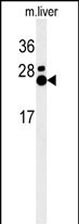 Rabbit Polyclonal Antibody to MMD (N-term)
