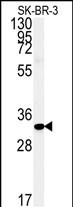Rabbit Polyclonal Antibody to FAM92A1