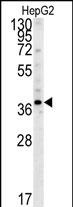 Rabbit Polyclonal Antibody to PSMD7