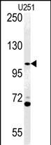 Rabbit Polyclonal Antibody to ACAP3  (N-term)