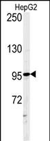 Rabbit Polyclonal Antibody to ATXN2L