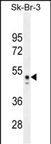 Rabbit Polyclonal Antibody to CNO6L