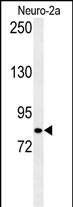 Rabbit Polyclonal Antibody to CQ028