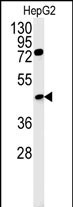 Rabbit Polyclonal Antibody to CT054