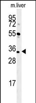 Rabbit Polyclonal Antibody to CU056