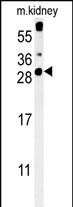 Rabbit Polyclonal Antibody to CXorf56 (N-term)