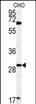 Rabbit Polyclonal Antibody to LHPL2