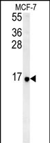 Rabbit Polyclonal Antibody to RPS26 (N-term)