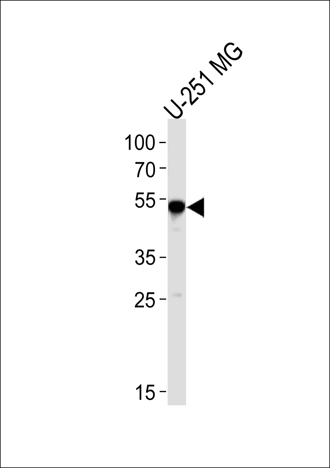 Rabbit Polyclonal Antibody to SCRN1 (N-term)