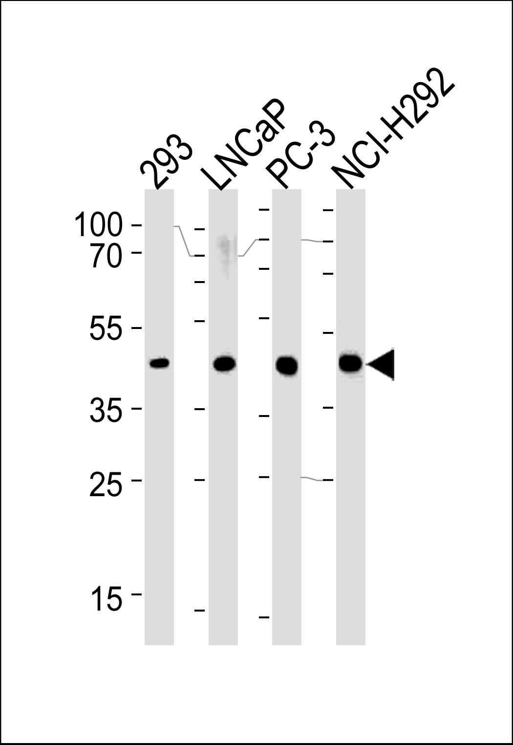 Rabbit Polyclonal Antibody to SRD5A3