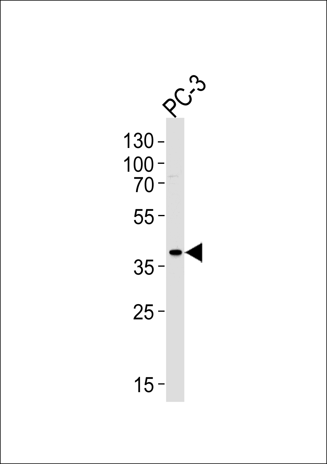 Rabbit Polyclonal Antibody to TMM79  (C-term)