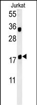 Rabbit Polyclonal Antibody to TPC6A (N-term)