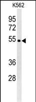 Rabbit Polyclonal Antibody to WDR73 (N-term)