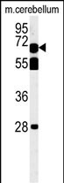 Rabbit Polyclonal Antibody to TBKB1  (N-term)