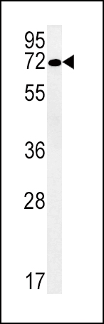 Rabbit Polyclonal Antibody to SLC19A3