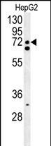Rabbit Polyclonal Antibody to SFRS16
