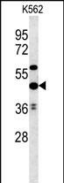 Rabbit Polyclonal Antibody to UBAC1