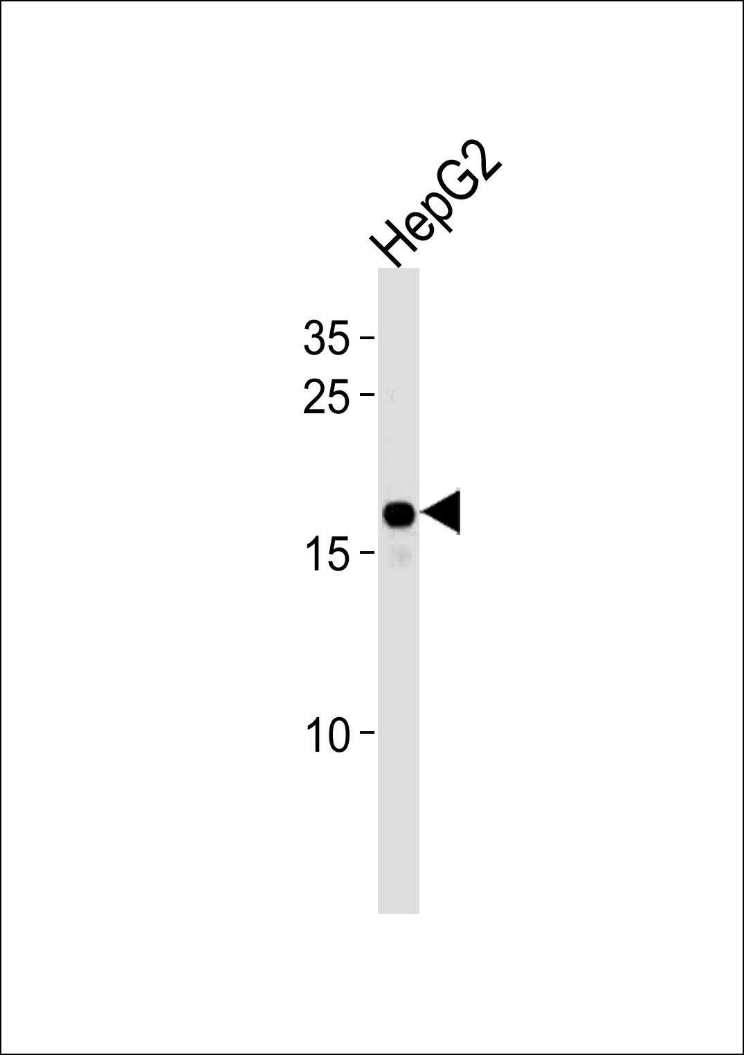 Rabbit Polyclonal Antibody to HMGA2