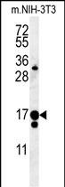 Rabbit Polyclonal Antibody to C14orf179