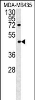 Rabbit Polyclonal Antibody to PYHIN1 (N-term)