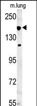 Rabbit Polyclonal Antibody to IFT172 (N-term)