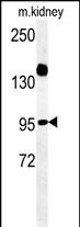 Rabbit Polyclonal Antibody to ARMC5