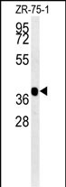 Rabbit Polyclonal Antibody to NIPAL2 (N-term)