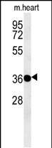 Rabbit Polyclonal Antibody to PTAFR