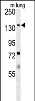 Rabbit Polyclonal Antibody to ATP11C