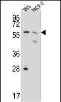Rabbit Polyclonal Antibody to PGD