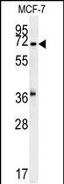 Rabbit Polyclonal Antibody to C7orf28A