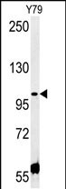 Rabbit Polyclonal Antibody to CCDC146 (N-term)