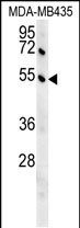 Rabbit Polyclonal Antibody to GKAP1