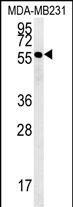 Rabbit Polyclonal Antibody to RAB11FIP2