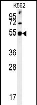 Rabbit Polyclonal Antibody to SYT13 (N-term)
