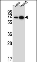 Rabbit Polyclonal Antibody to WDR43