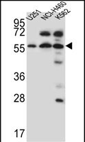 Rabbit Polyclonal Antibody to KLH20