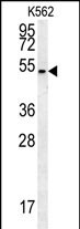 Rabbit Polyclonal Antibody to HHAT (N-term)