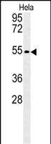Rabbit Polyclonal Antibody to KLF17  (C-term)