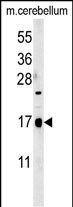 Rabbit Polyclonal Antibody to CA095  (C-term)
