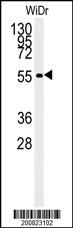 Mouse Monoclonal Antibody to ALDH3A2