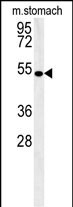 Rabbit Polyclonal Antibody to CORO6