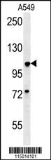 Rabbit Polyclonal Antibody to BUB1A (N-term)