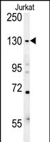 Rabbit Polyclonal Antibody to EHMT2 (N-term)