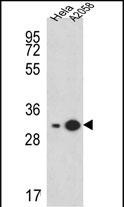 Rabbit Polyclonal Antibody to RPS3A