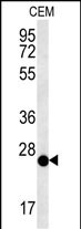 Rabbit Polyclonal Antibody to CRISPLD2 (N-term)