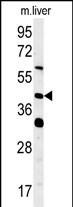 Rabbit Polyclonal Antibody to SMCR7L (N-term)